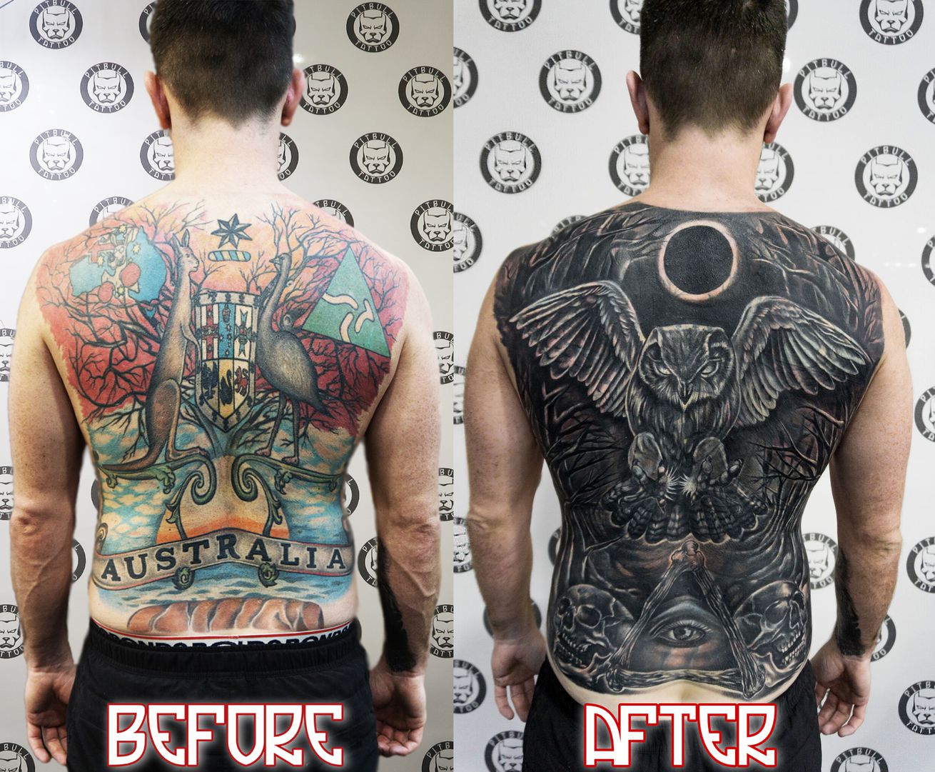 Cover up Vs Laser Tattoo Removal  10 Masters